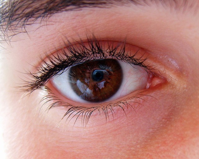 Jak leczyć jęczmień w oku?